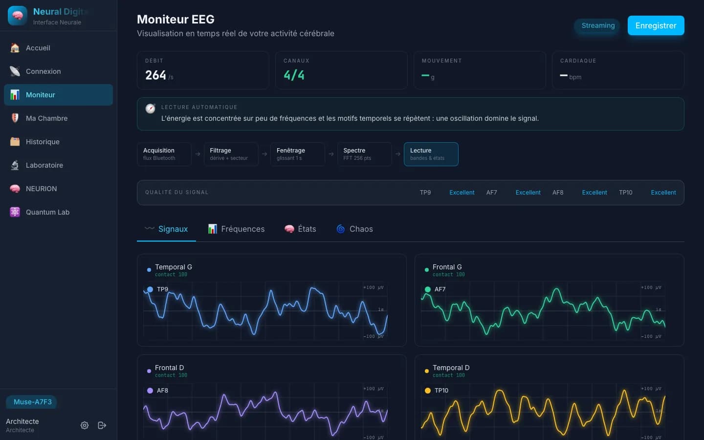 Moniteur EEG en temps réel : 4 électrodes et qualité du signal